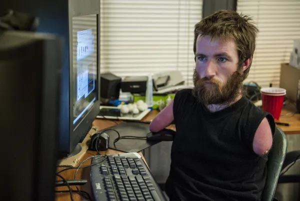 Il devient joueur pro en n’ayant ni bras ni jambes